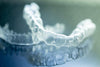 Why You Should Choose Invisible Aligners Over DIY Braces and Other Teeth Straightening Methods